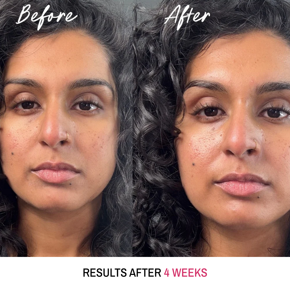 Overachiever Moisturiser